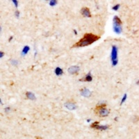CDC25B Rabbit Polyclonal Antibody