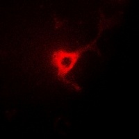 CDC25B Rabbit Polyclonal Antibody