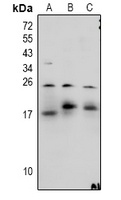 MBP Rabbit Polyclonal Antibody