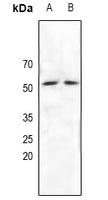 NRF1 Rabbit Polyclonal Antibody