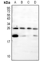 Pleiotrophin Rabbit Polyclonal Antibody