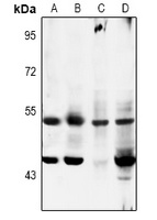 MKK5 (Phospho-S311) Rabbit Polyclonal Antibody