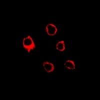 EMR3 Rabbit Polyclonal Antibody
