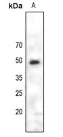 PAX6 Rabbit Polyclonal Antibody
