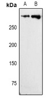Ki67 Rabbit Polyclonal Antibody