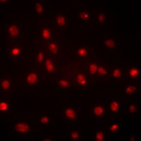 DDX39B Mouse Monoclonal Antibody
