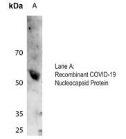 COVID-19 Nucleocapsid Protein Rabbit Polyclonal Antibody