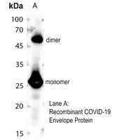 COVID-19 Envelope Protein Rabbit Polyclonal Antibody