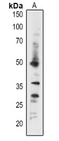 ABI5 Rabbit Polyclonal Antibody