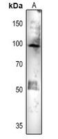 ACO1 Rabbit Polyclonal Antibody