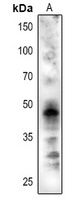 CRD1 Rabbit Polyclonal Antibody