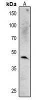 MPK6 Rabbit Polyclonal Antibody