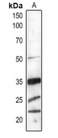PSBO1/2 Rabbit Polyclonal Antibody
