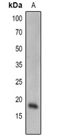 SCE1 Rabbit Polyclonal Antibody