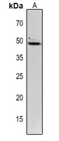 TIC40 Rabbit Polyclonal Antibody
