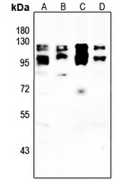 IFNAR2 Rabbit Polyclonal Antibody