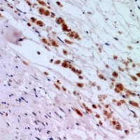 IFNAR2 Rabbit Polyclonal Antibody