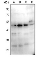 CD1a/b Rabbit Polyclonal Antibody