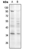 Cyclin D1 (Phospho-S90) Rabbit Polyclonal Antibody