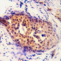 Cyclin D1 (Phospho-S90) Rabbit Polyclonal Antibody
