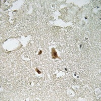 SMAD2 (Phospho-T220) Rabbit Polyclonal Antibody