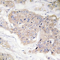 CD124 (Phospho-Y497) Rabbit Polyclonal Antibody