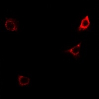 CD124 (Phospho-Y497) Rabbit Polyclonal Antibody