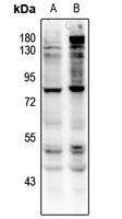 CD127 (Phospho-Y449) Rabbit Polyclonal Antibody