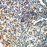 CD127 (Phospho-Y449) Rabbit Polyclonal Antibody