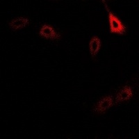CD127 (Phospho-Y449) Rabbit Polyclonal Antibody