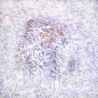 Aconitase 1 (Phospho-S138) Rabbit Polyclonal Antibody