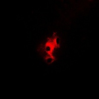 Aconitase 1 (Phospho-S138) Rabbit Polyclonal Antibody