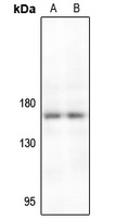 TIE2 Rabbit Polyclonal Antibody