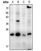 BAD Rabbit Polyclonal Antibody