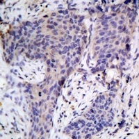 BAD Rabbit Polyclonal Antibody