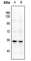 JNK1/2/3 Rabbit Polyclonal Antibody