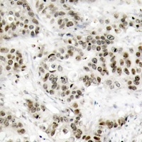 JNK1/2/3 Rabbit Polyclonal Antibody