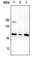 MERTK/TYRO3 Rabbit Polyclonal Antibody