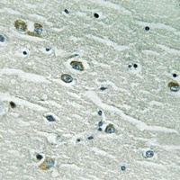 MERTK/TYRO3 Rabbit Polyclonal Antibody