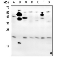 VEGF165 Rabbit Polyclonal Antibody