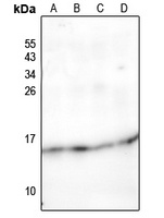 NDUFC2 Rabbit Polyclonal Antibody