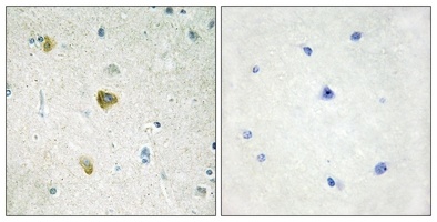 NDUFC2 Rabbit Polyclonal Antibody