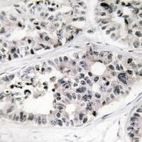 Collagen 7 alpha 1 Rabbit Polyclonal Antibody
