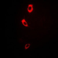 Collagen 7 alpha 1 Rabbit Polyclonal Antibody