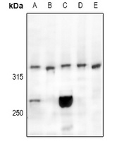 CELSR3 Rabbit Polyclonal Antibody