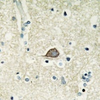 CELSR3 Rabbit Polyclonal Antibody