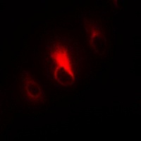 Collagen 4 alpha 3 Rabbit Polyclonal Antibody
