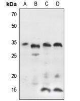 IGFBP7 Rabbit Polyclonal Antibody