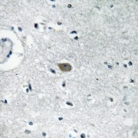 IGFBP7 Rabbit Polyclonal Antibody