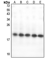 GPSM3 Rabbit Polyclonal Antibody